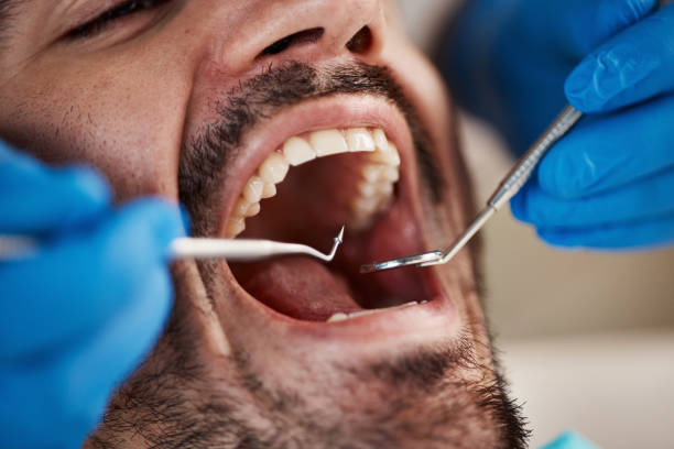Dental Inlays and Onlays in Garland, NC